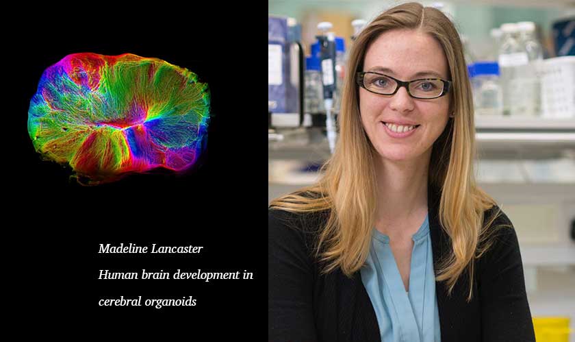 Cambridge researchers create â€˜mini-brain on the move' 